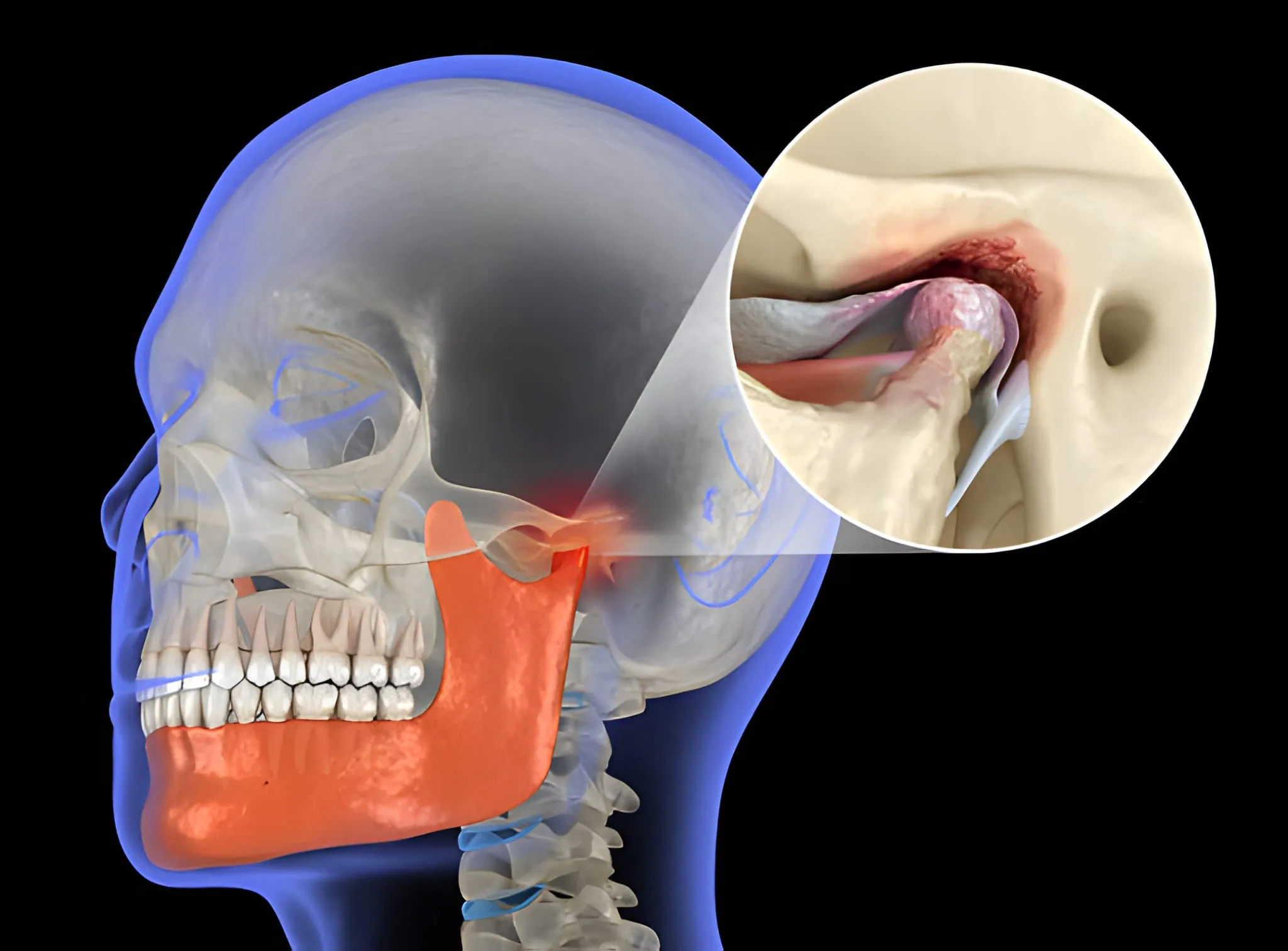 Leaders in Noninvasive TMJ Innovation